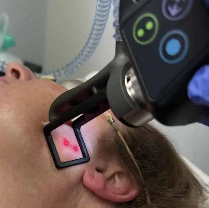 tetra-pro-c02-at-scg-spa Skin Care & Facials (Med Spa)